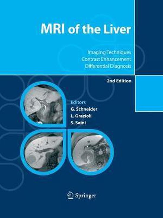 MRI of the Liver - cover