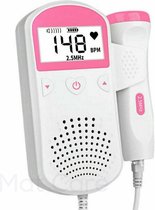 Mat Care doppler - hartslagmonitor - hart monitor - hartslag baby - fetal doppler - ultrasonic fetal doppler