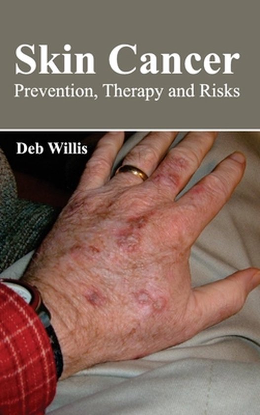 Skin Cancer Prevention, Therapy and Risks 9781632423764 Boeken bol