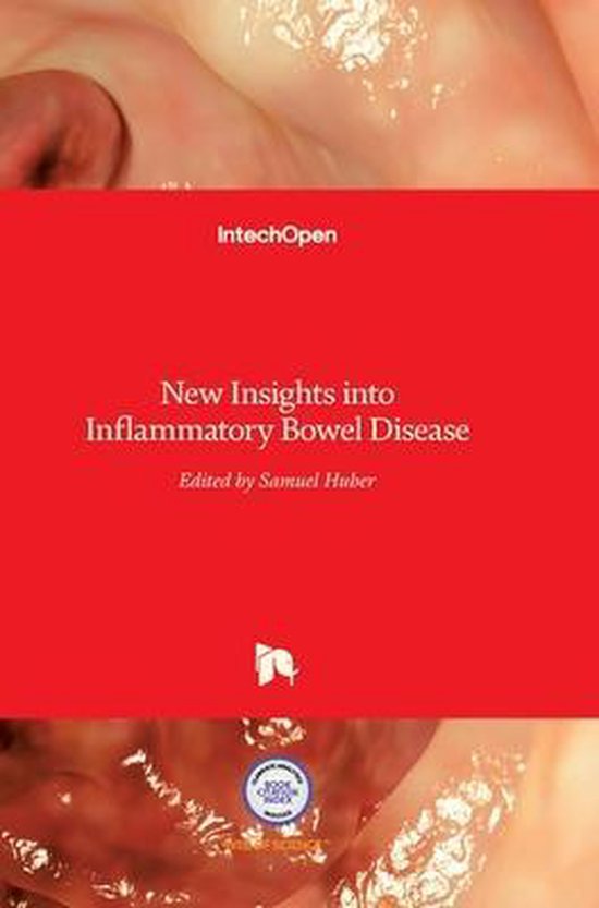 New Insights Into Inflammatory Bowel Disease 9789535127543 Boeken 9027