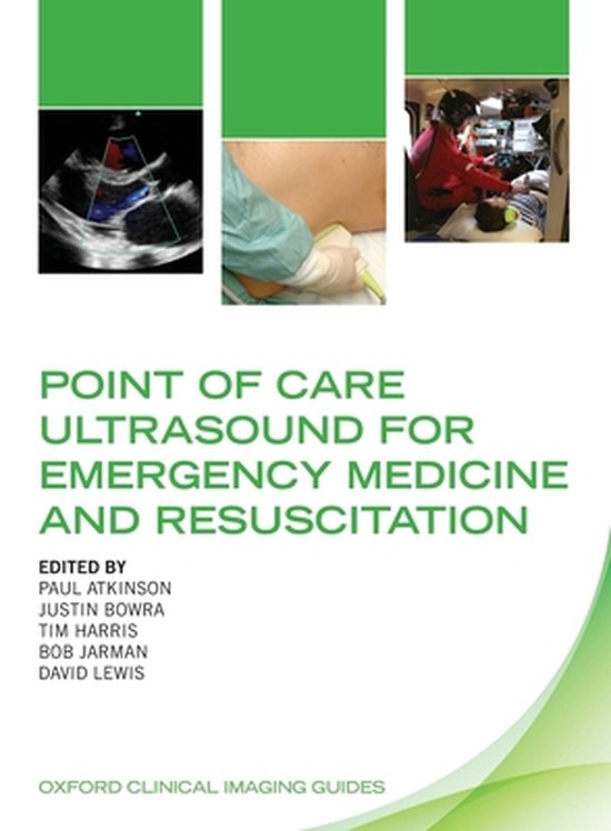Boek cover Point of Care Ultrasound for Emergency Medicine and Resuscitation van Atkinson, Paul (Paperback)