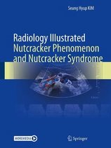 Radiology Illustrated- Radiology Illustrated: Nutcracker Phenomenon and Nutcracker Syndrome