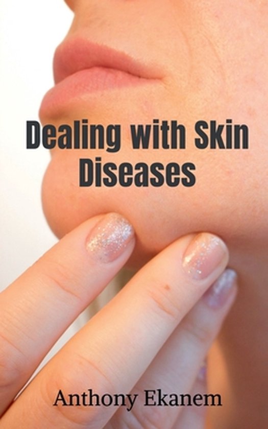 Dealing with Skin Diseases - cover