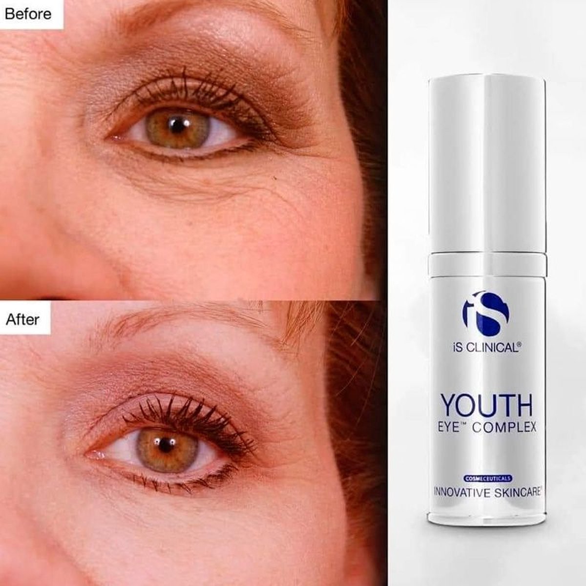 iS Clinical Youth Eye Complex | 15g