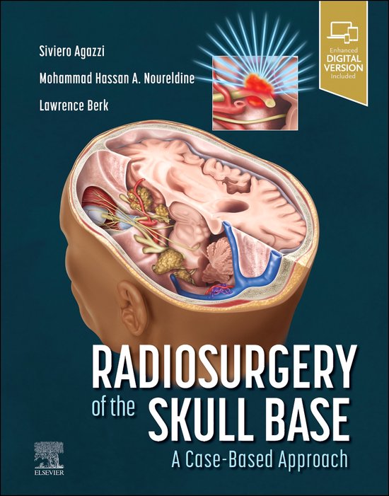 Radiosurgery of the Skull Base A CaseBased Approach 9780323874373