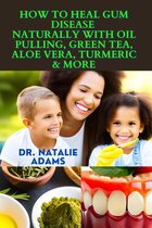 How To Heal Gum Disease­ Naturally with Oil Pulling, Gree­n Tea, Aloe Vera, Turmeric & More