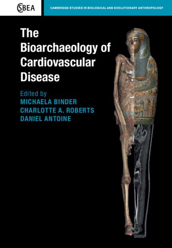 Cambridge Studies in Biological and Evolutionary AnthropologySeries Number 91-The Bioarchaeology of Cardiovascular Disease