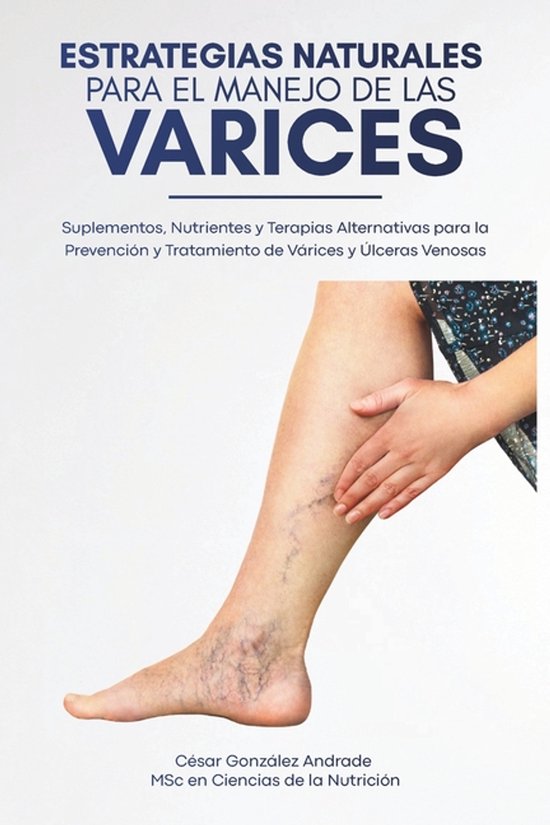 Estrategias Naturales para el Manejo de las Varices - cover