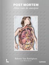 Post mortem. Atlas van de autopsie