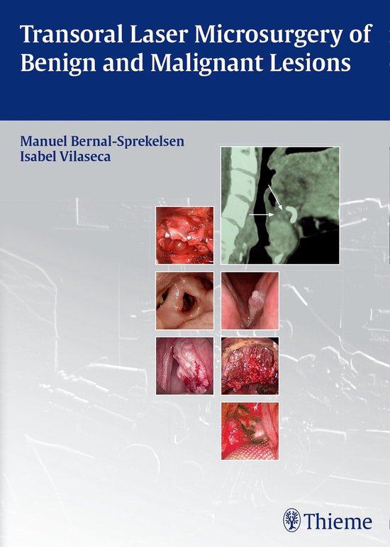 Transoral Laser Microsurgery of Benign and Malignant Lesions - cover