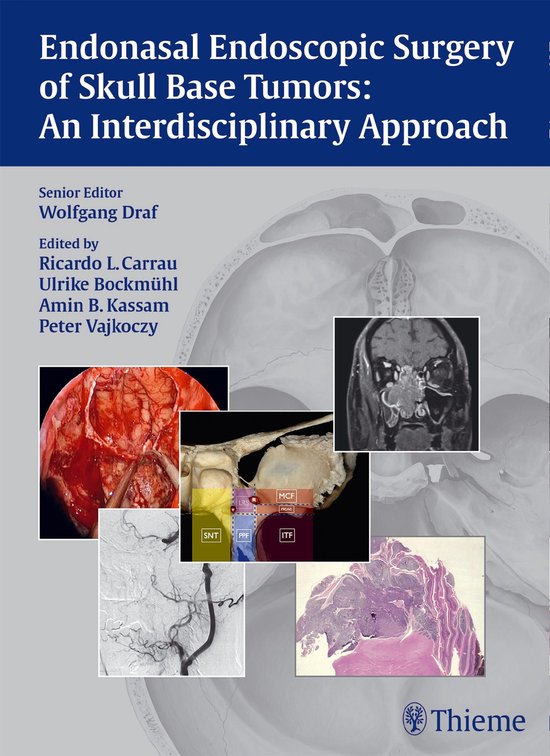 Endonasal Endoscopic Surgery of Skull Base Tumors: An Interd ... - cover