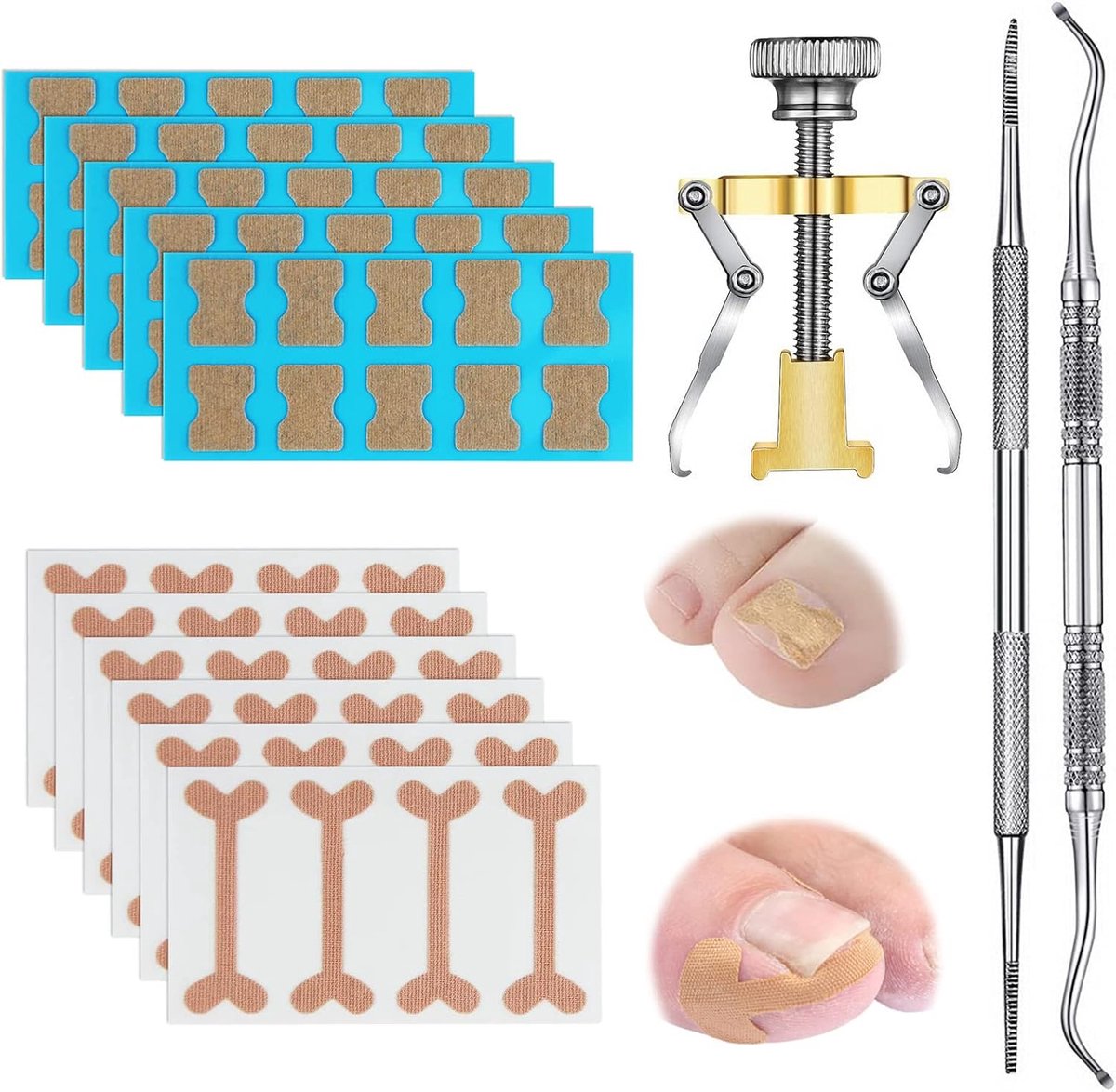 Gereedschapsset voor Ingegroeide Teennagels,Teennagels Corrector voor Ingegroeide,inclusief elastische patch, gebogen teennagels, ingegroeide correctiestickers, teennagelvijl en lifter