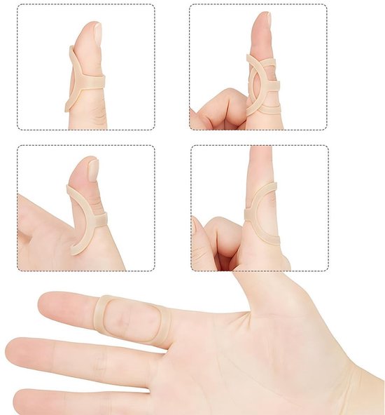 Set van 5 Vingerbeschermers, Vinger Splints, Duim Splints, Waterdichte Plastic Ortheses voor Hamervingers en Artrose — afbeelding 2