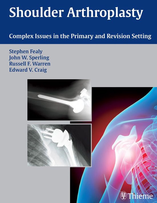 Shoulder Arthroplasty - cover