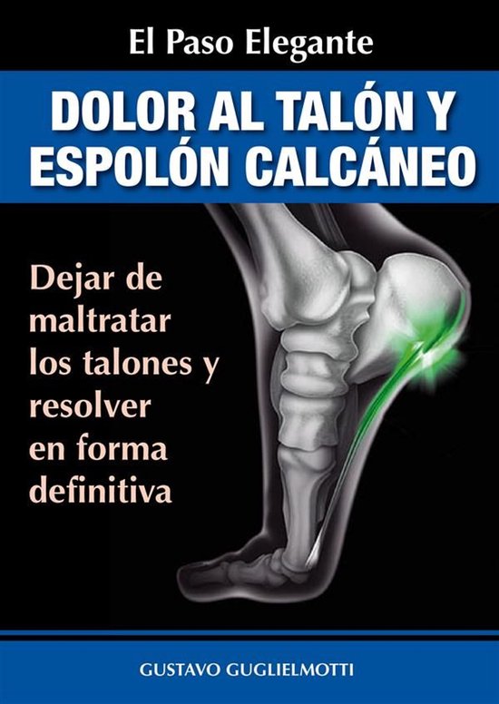 Dolor en los talones y Espolón calcáneo - cover
