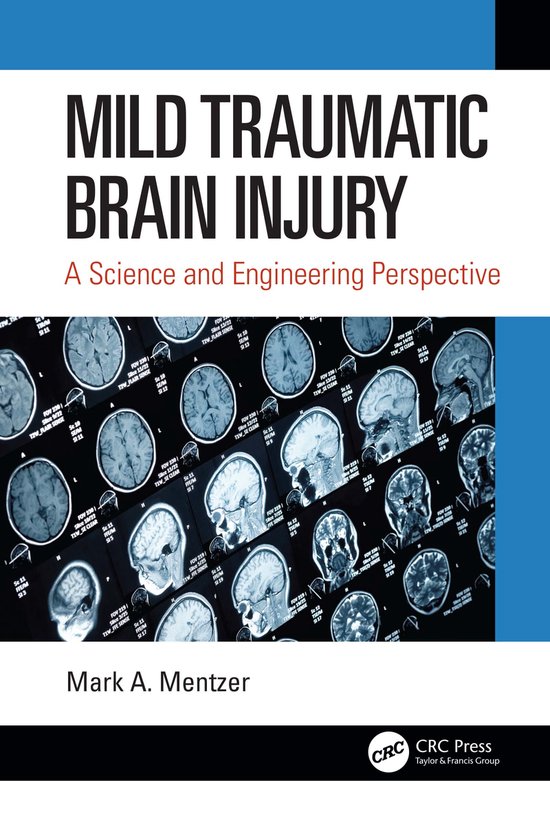 Mild Traumatic Brain Injury | 9780367567767 | Mark A. Mentzer | Boeken ...