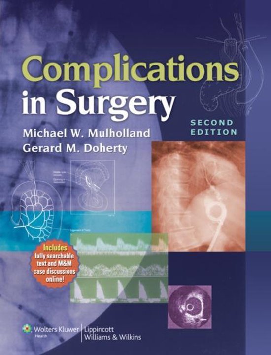 Complications In Surgery - cover