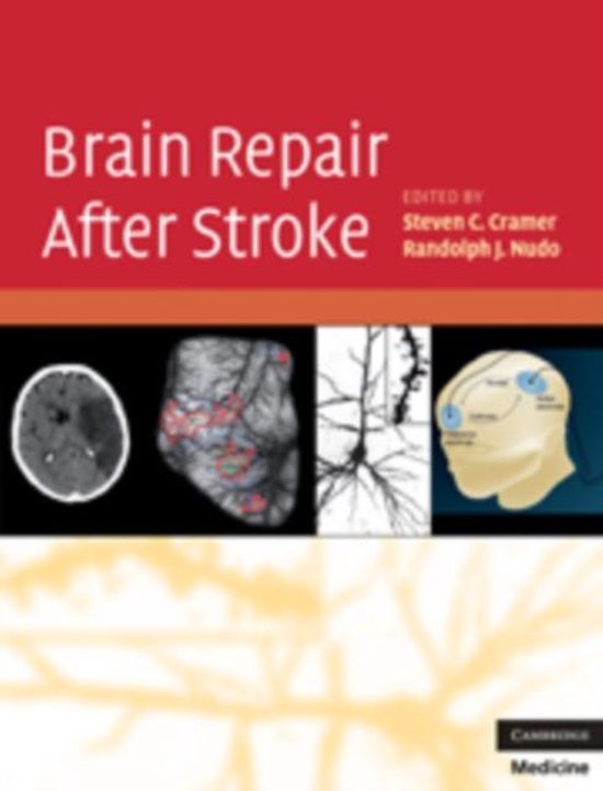 Brain Repair After Stroke 9780521515337 Steven C Cramer Boeken bol