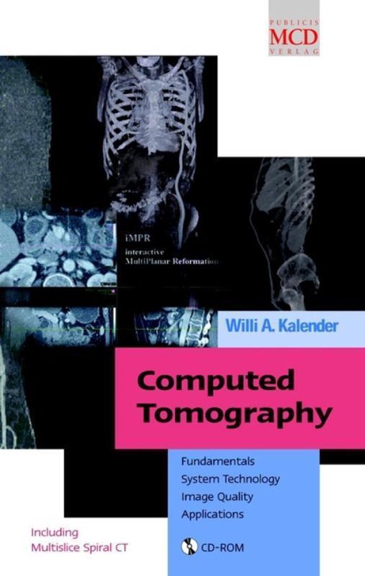 Computed Tomography, Willi A. Kalender  9783895780813  Boeken  bol