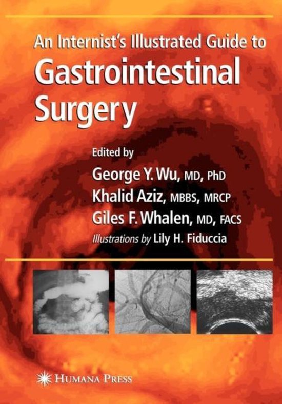 An Internist's Illustrated Guide to Gastrointestinal Surgery