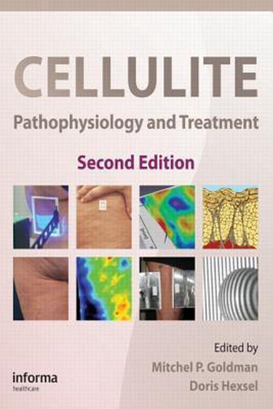 Cellulite - cover