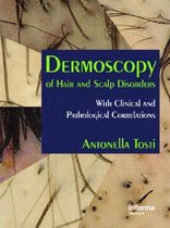 Dermoscopy of Hair and Scalp Disorders