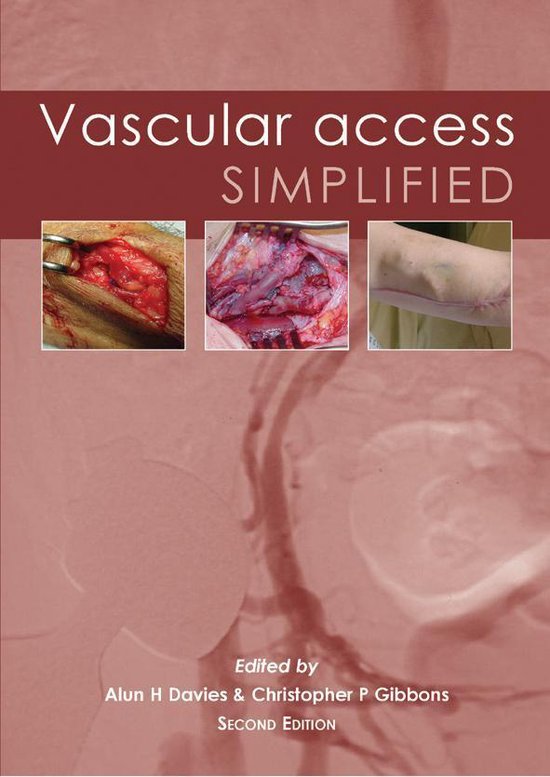Vascular Access Simplified; second edition - cover