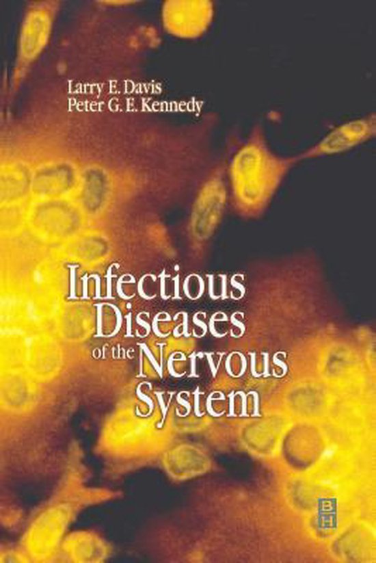 Infectious Diseases of the Nervous System | 9780750642132 | Larry Davis ...