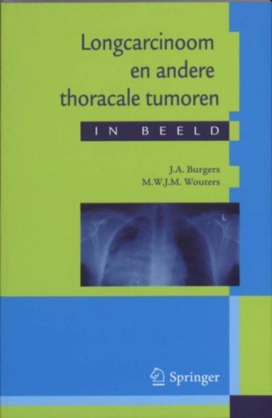 Longcarcinoom en andere thoracale tumoren in beeld - cover