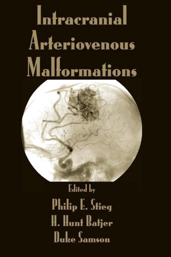 Intracranial Arteriovenous Malformations - cover