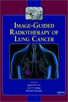 Image-Guided Radiotherapy of Lung Cancer