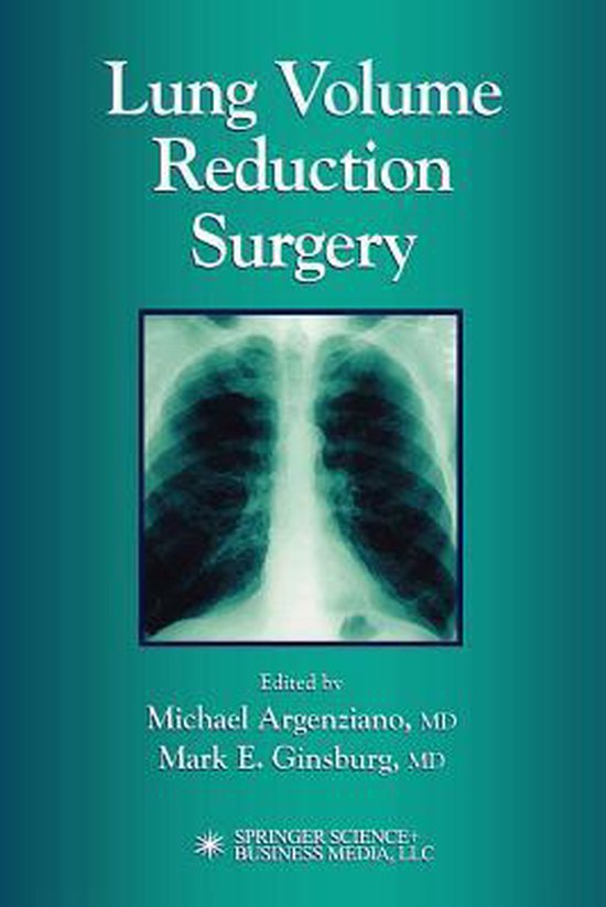 Lung Volume Reduction Surgery 9781617372209 Boeken