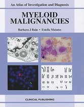 Myeloid Malignancies