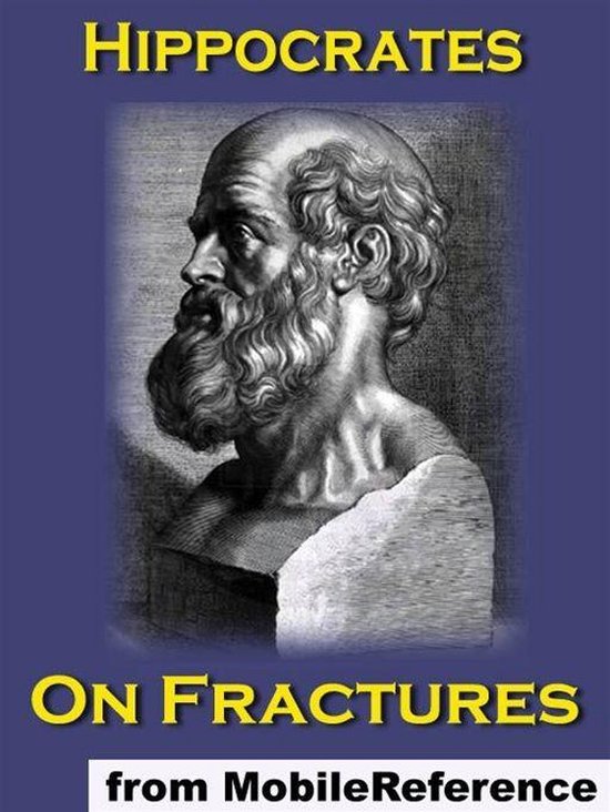 On Fractures (Mobi Classics) - cover