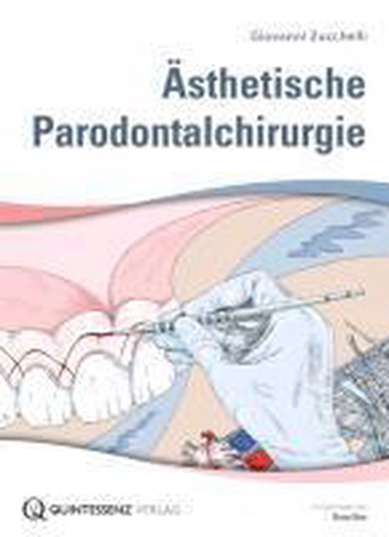Ästhetische Parodontalchirurgie - cover