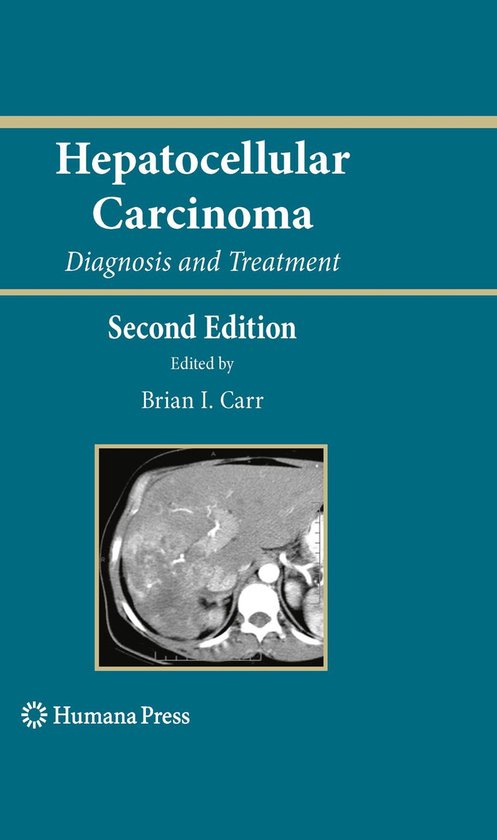 Medicine (R0) - Hepatocellular Carcinoma - cover