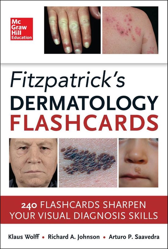 Fitzpatricks Dermatology Flash Cards - cover