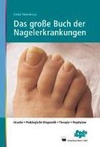 Das große Buch der Nagelerkrankungen