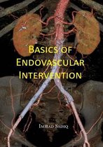 Basics of Endovascular Intervention