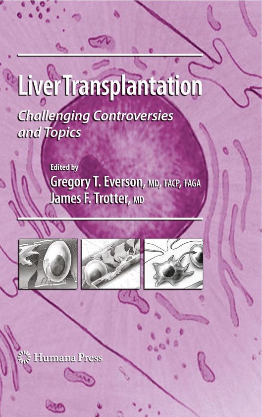 Medicine (R0) - Liver Transplantation - cover