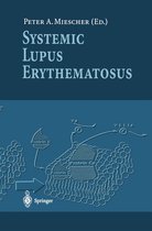 Systemic Lupus Erythematosus
