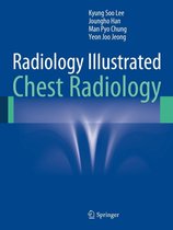 Radiology Illustrated - Radiology Illustrated: Chest Radiology