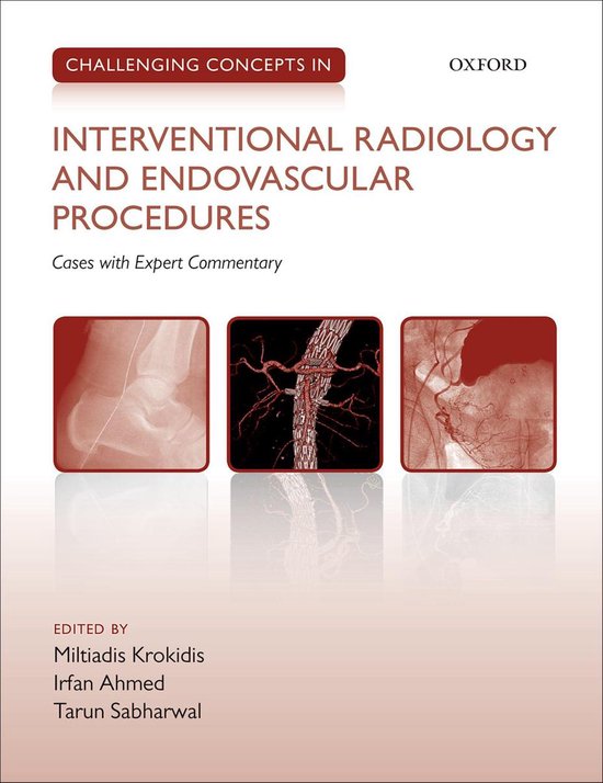 Challenging Cases - Challenging Concepts in Interventional R ... - cover