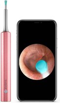 Bebird C3 Otoscoop (gehoorgangreiniger) met camera - roze
