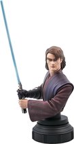 Star Wars: The Clone Wars - Anakin Skywalker 1/7 Bust