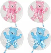 Baby ballon - Roze - Folie ballon - Themafeest - Babyshower - Geboorte - It's a Girl - Versiering - Ballonnen - Helium ballon - Geboorte Cadeau Meisje - Kraam Ballon - Babyshower versiering - Baby shower folie ballonnen