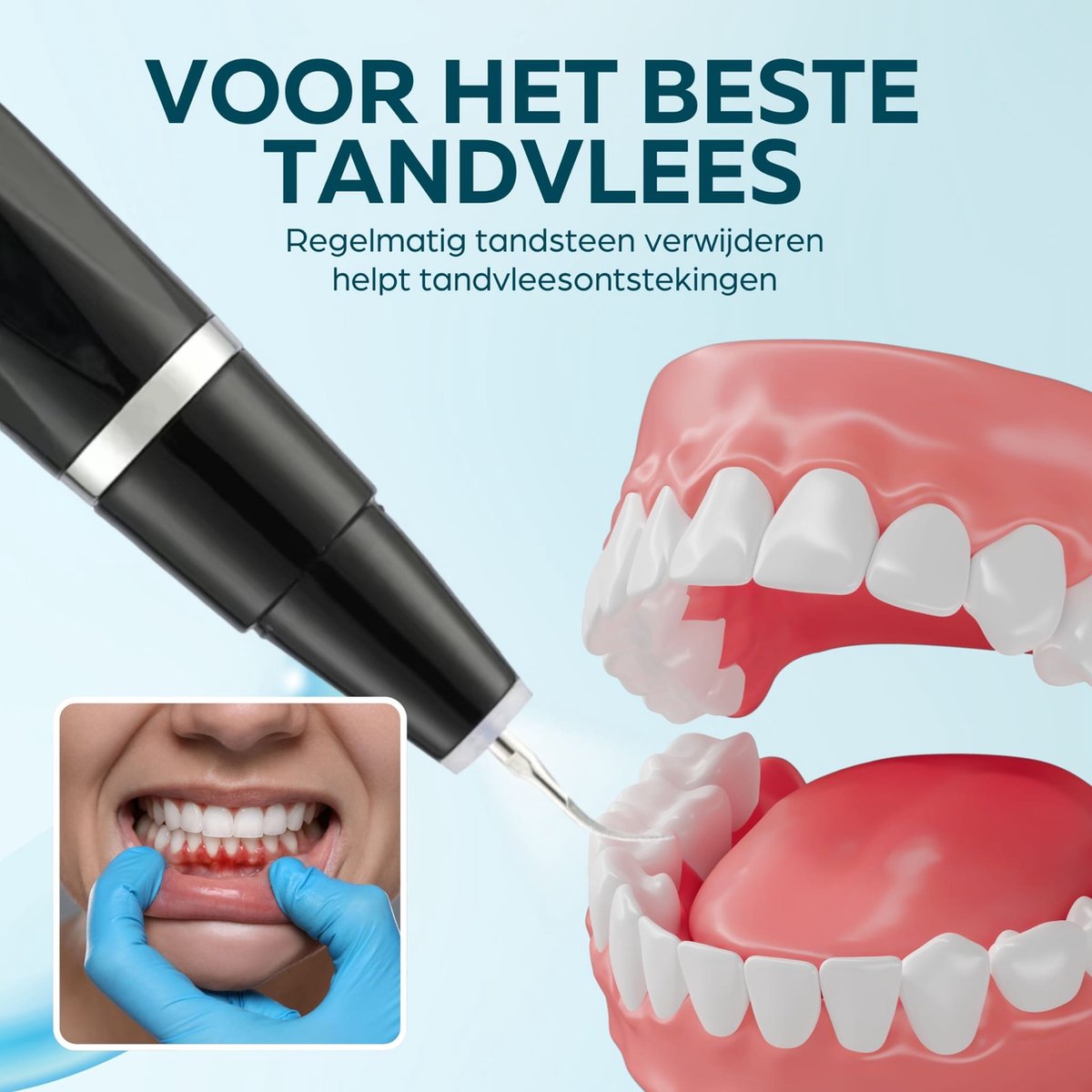 Détartreur Dentaire - Kit Blanchiment Des Dents - Hygiène Bucco-dentaire - Neuf, Marque GlobalShop