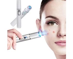 Blauw Licht Gezicht Laserpen - Acne & Rimpel Verwijdering - Face Acne Laser Pen - Gezicht -…