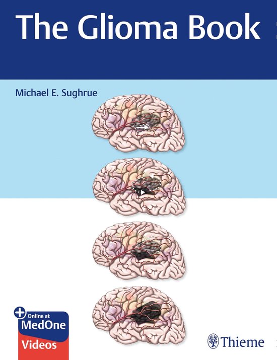 The Glioma Book - cover