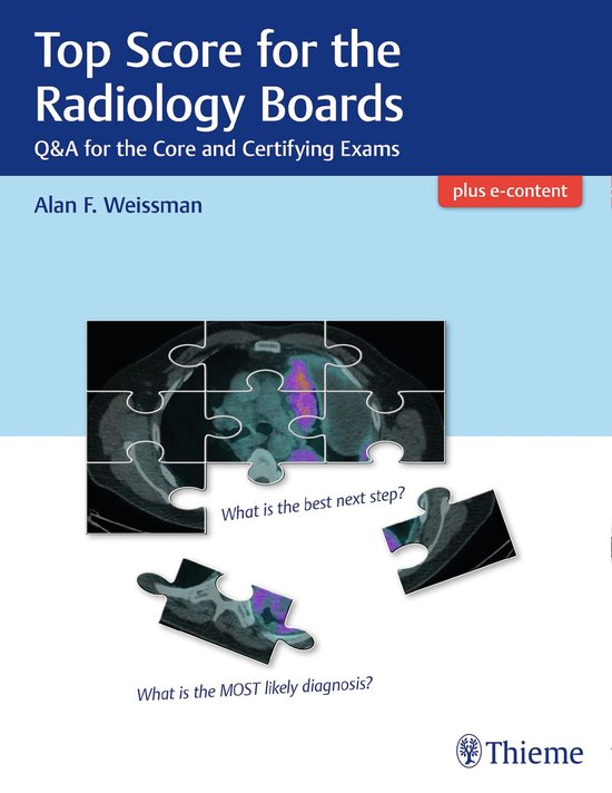 Top Score for the Radiology Boards - cover